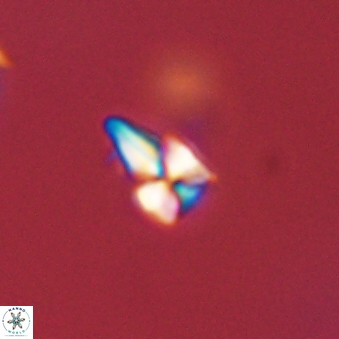 Sphenolithus radians 45101