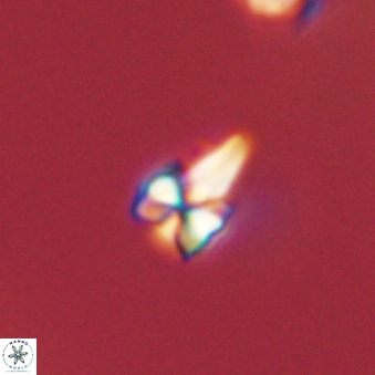 Sphenolithus radians 45104