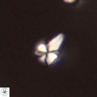 Sphenolithus radians 45105
