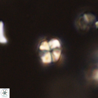 Sphenolithus radians 45106