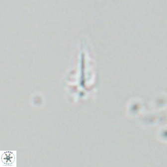 Sphenolithus radians 26015