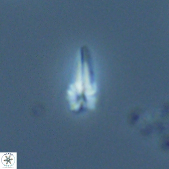 Sphenolithus radians 26016