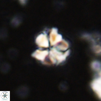 Sphenolithus wardiae 43421