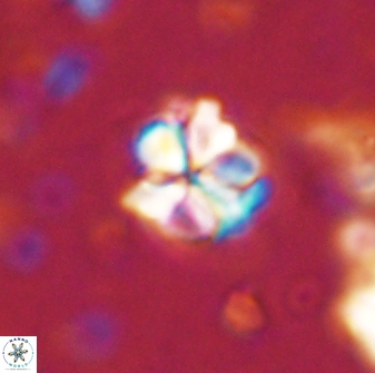 Sphenolithus wardiae 43422