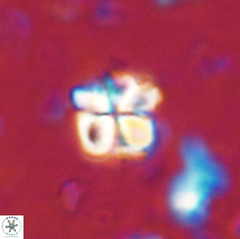 Sphenolithus emelineae 43423