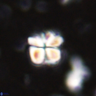 Sphenolithus emelineae 43424