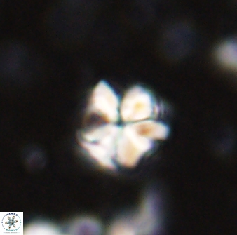 Sphenolithus wardiae 43425