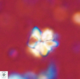 Sphenolithus wardiae 43426