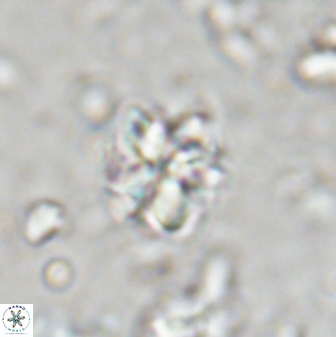 Sphenolithus wardiae 43427