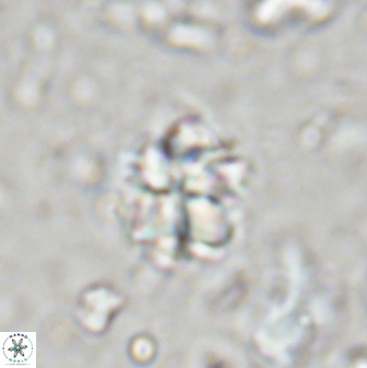 Sphenolithus wardiae 43428