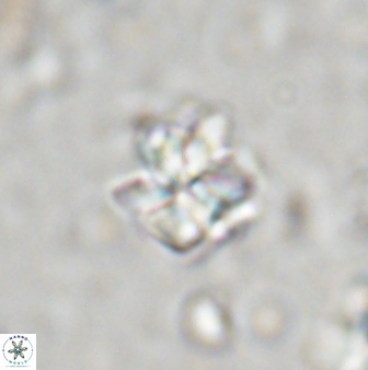 Sphenolithus wardiae 43429