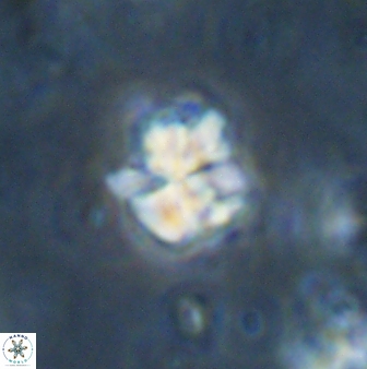 Sphenolithus wardiae 43430