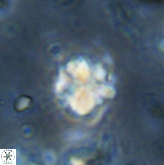 Sphenolithus wardiae 43432