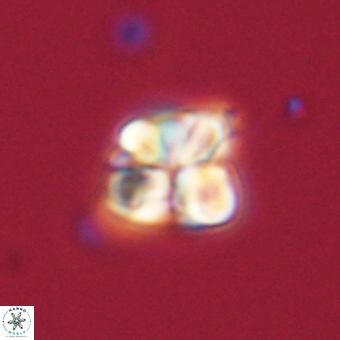 Sphenolithus wardiae 67941