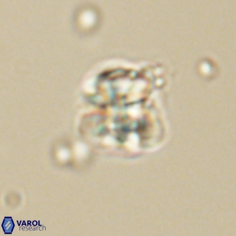 Sphenolithus wardiae 67943