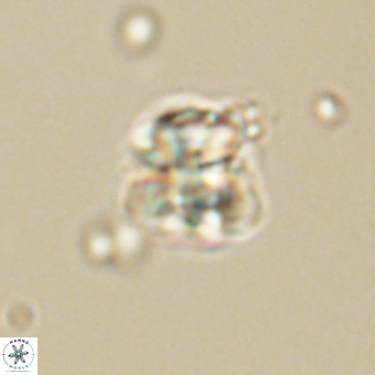 Sphenolithus wardiae 67943