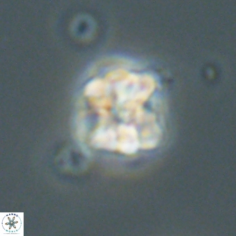 Sphenolithus wardiae 67945