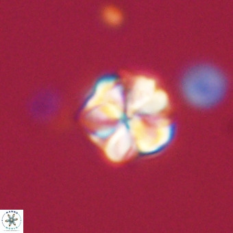 Sphenolithus wardiae 67949