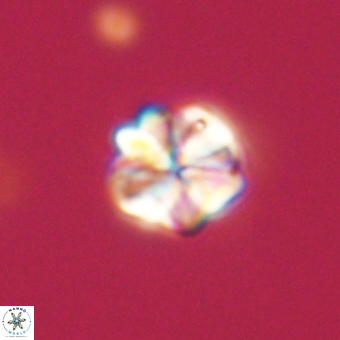 Sphenolithus wardiae 67956