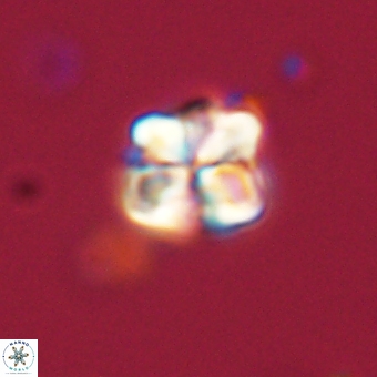 Sphenolithus wardiae 67932