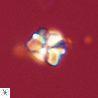 Sphenolithus wardiae 67936