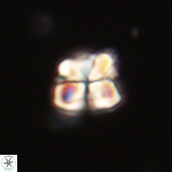 Sphenolithus wardiae 67938
