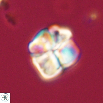 Sphenolithus wardiae 69043