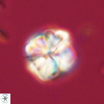 Sphenolithus wardiae 69046