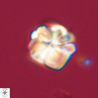Sphenolithus wardiae 69047