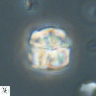 Sphenolithus wardiae 69052