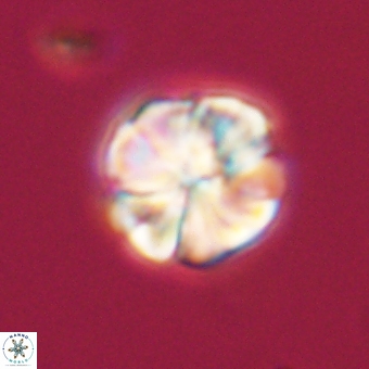 Sphenolithus wardiae 69053