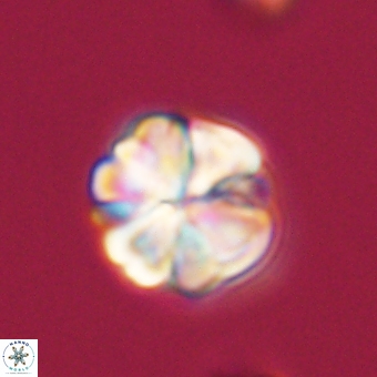 Sphenolithus wardiae 69056