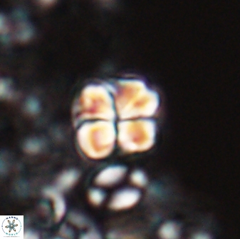 Sphenolithus wardiae 28713