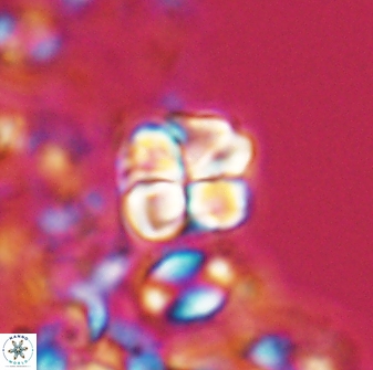 Sphenolithus wardiae 28714