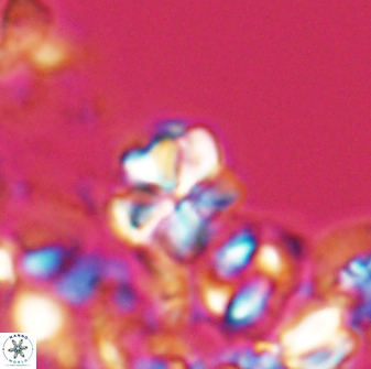 Sphenolithus wardiae 28715