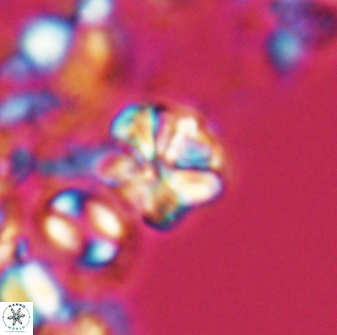 Sphenolithus wardiae 28718