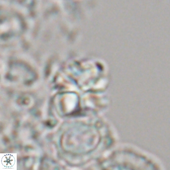 Sphenolithus wardiae 28719