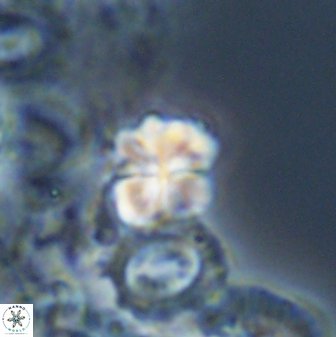 Sphenolithus wardiae 28721