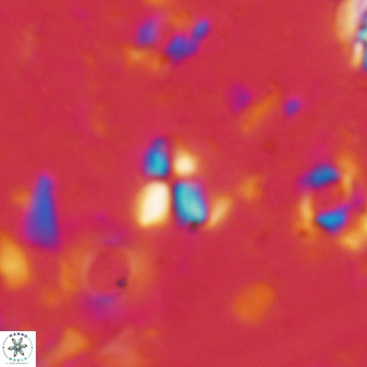 Sphenolithus tintinnabulum 73