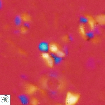 Sphenolithus tintinnabulum 71