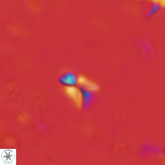 Sphenolithus tintinnabulum 76