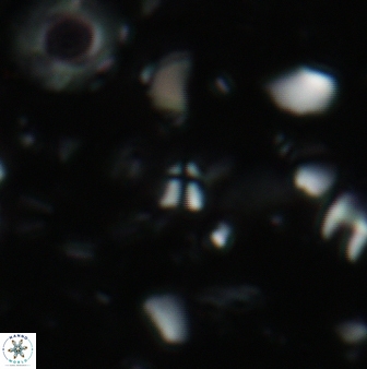 Sphenolithus tintinnabulum 78