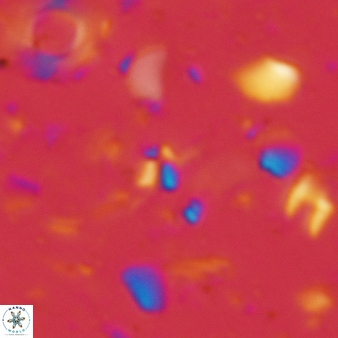 Sphenolithus tintinnabulum 79