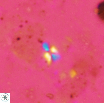 Sphenolithus tintinnabulum 2314