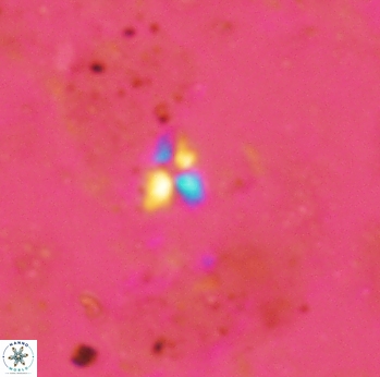 Sphenolithus tintinnabulum 2313