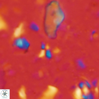 Sphenolithus tintinnabulum 275