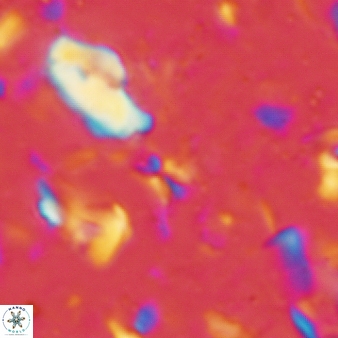 Sphenolithus tintinnabulum 277