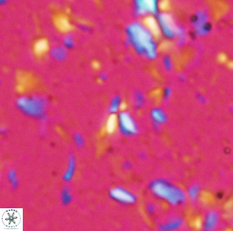 Sphenolithus tintinnabulum 28151