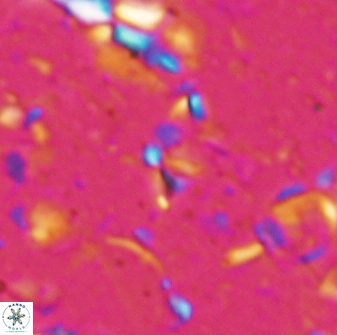 Sphenolithus tintinnabulum 28152
