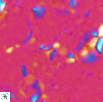 Sphenolithus tintinnabulum 28154